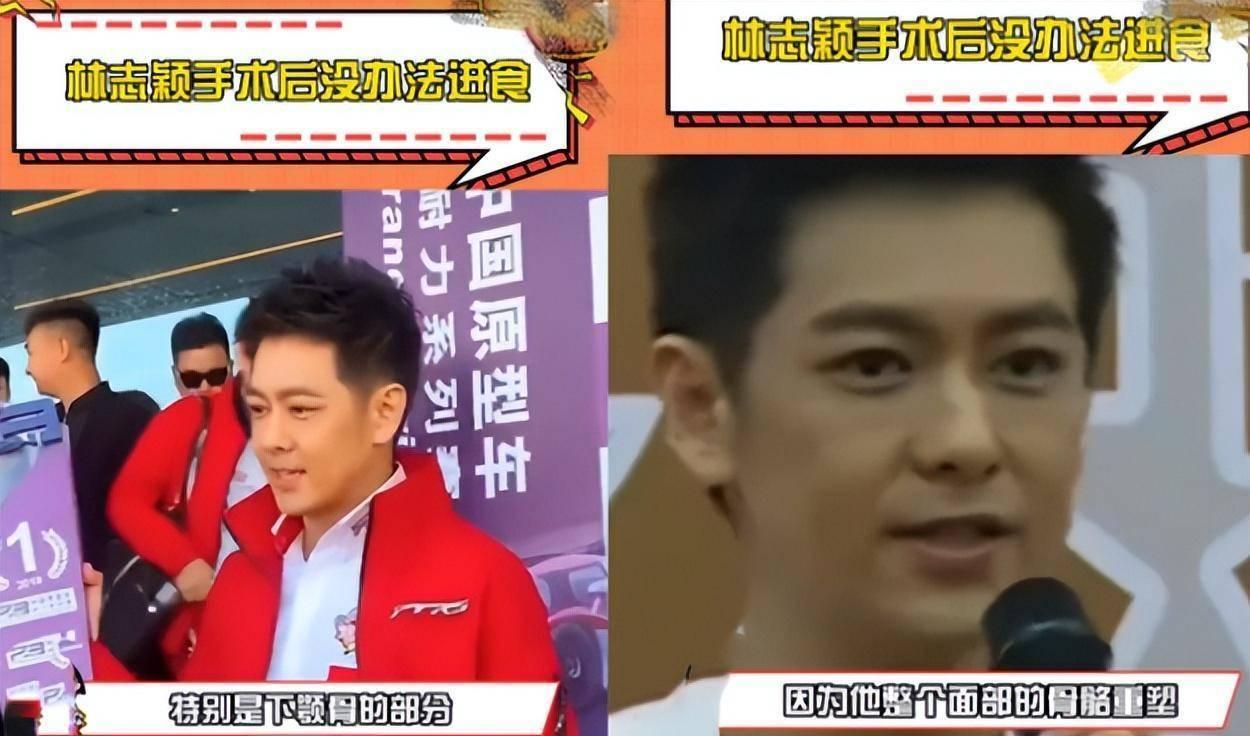 林志颖最新动态全面解读,影响与观点分析