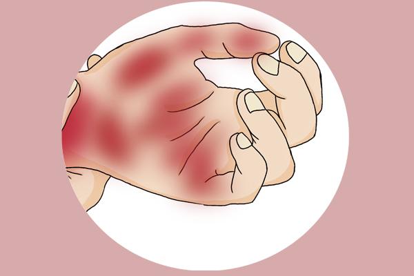 乙肝硬化最新论述与研究进展