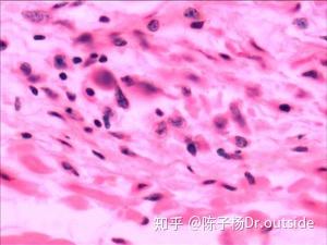 汉坦病毒最新动态,科学解读、预防策略与应对要点