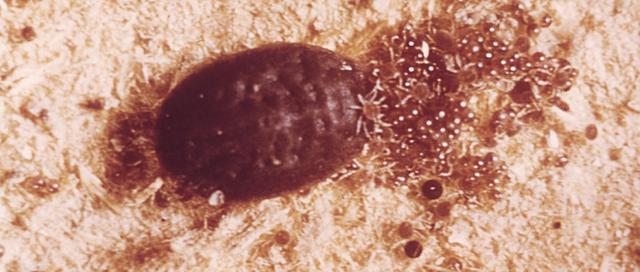 汉坦病毒最新动态,科学解读、预防策略与应对要点