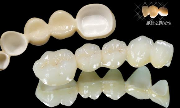 烤瓷牙价格探寻之旅,内心平静的冒险启程