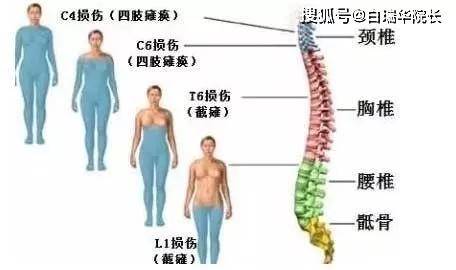 全球脊髓损伤最新进展概览