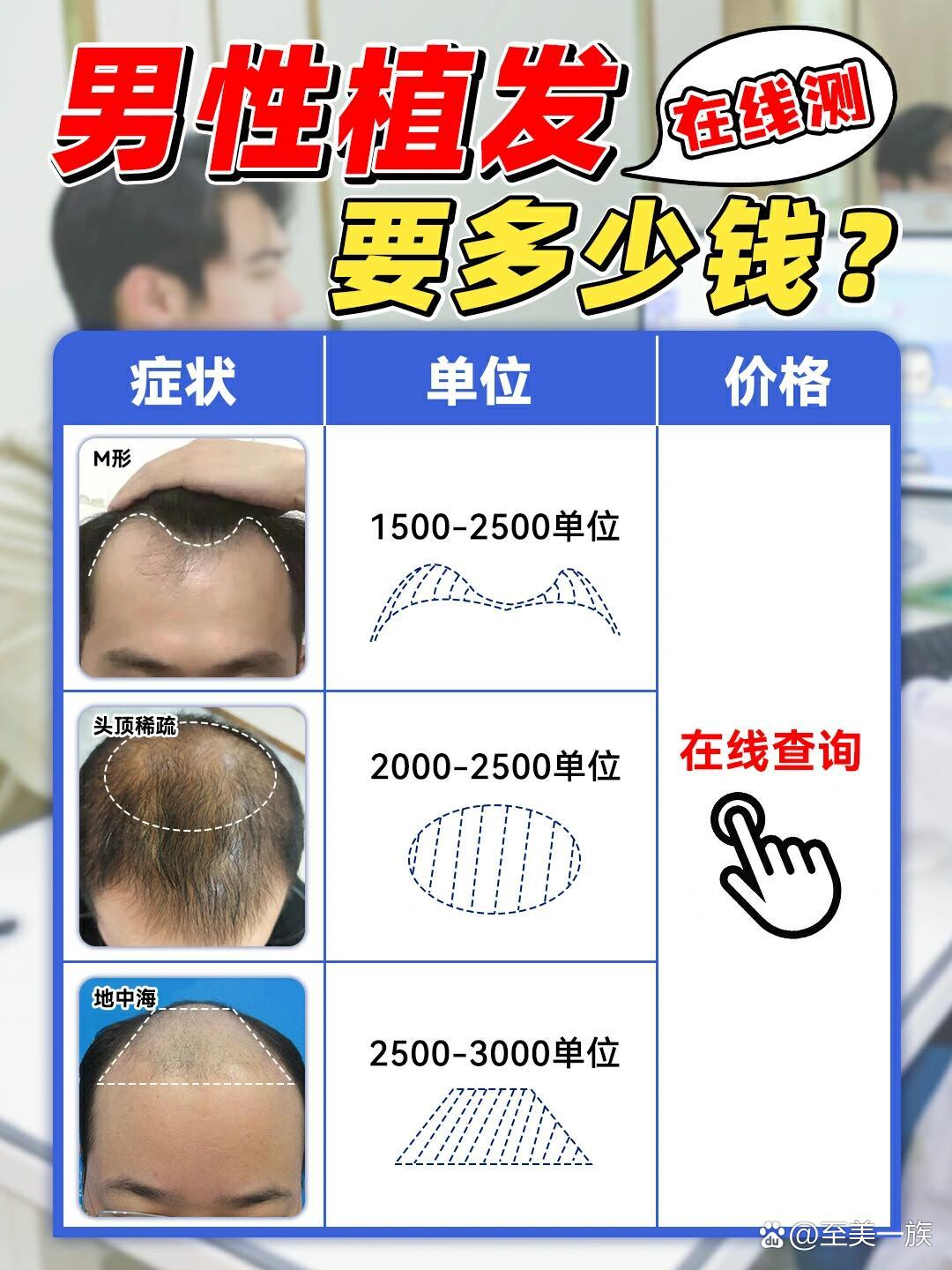 揭秘最新植发价格真相,植发费用全方位解析