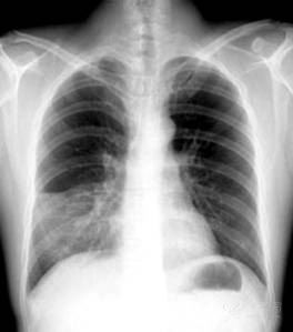 智能防护科技产品,守护最新肺炎名称下的健康防线