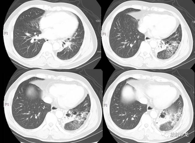 高科技重塑生活,支扩最新智能变革体验报告