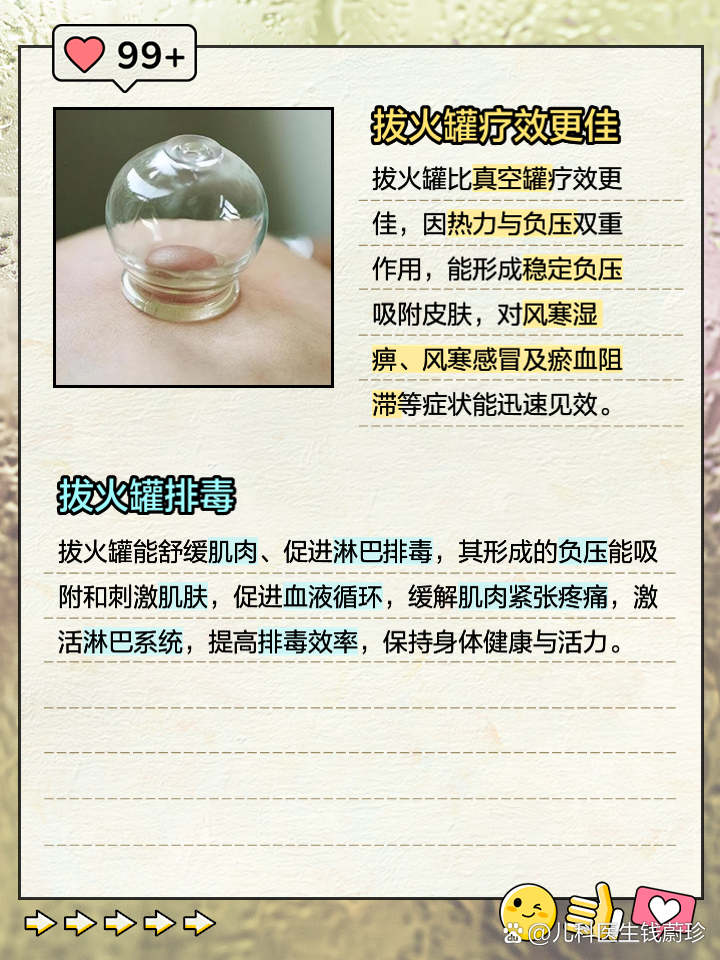 最新拔火罐,古老时尚的健康疗法体验